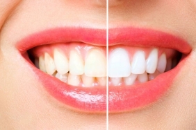 antalya dental clinic (2)