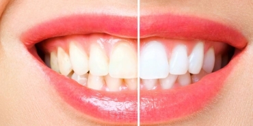 antalya dental clinic (2)