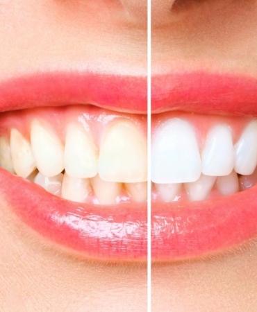 antalya dental clinic (2)