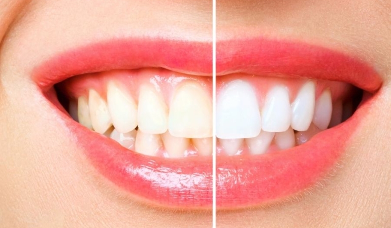 antalya dental clinic (2)