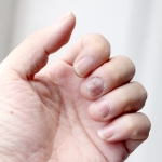 El Parmak Eğriliği (2)