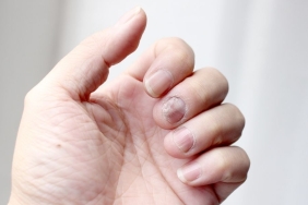 El Parmak Eğriliği (2)