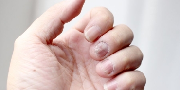 El Parmak Eğriliği (2)